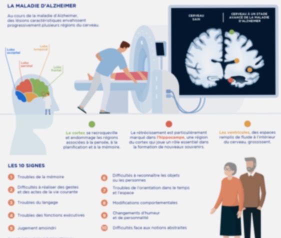 Donépézil générique pour Alzheimer